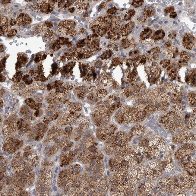 RAB29 Antibody in Immunohistochemistry (IHC)