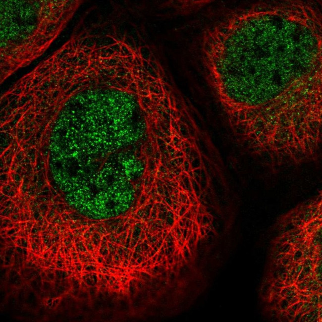 PSMB2 Antibody in Immunocytochemistry (ICC/IF)