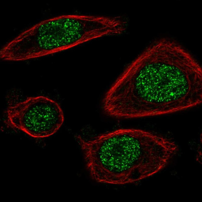 PSMB2 Antibody in Immunocytochemistry (ICC/IF)