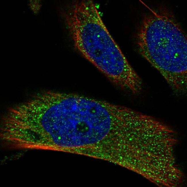 RAB14 Antibody in Immunocytochemistry (ICC/IF)