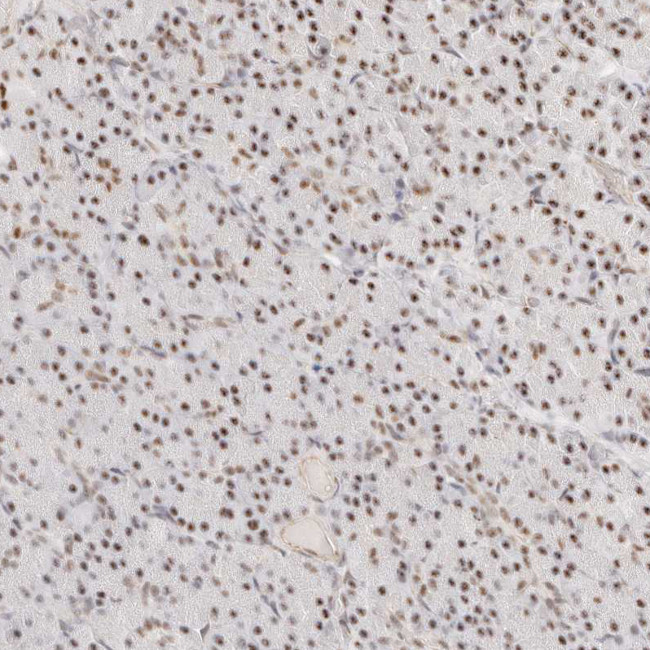 ZC3H11A Antibody in Immunohistochemistry (Paraffin) (IHC (P))