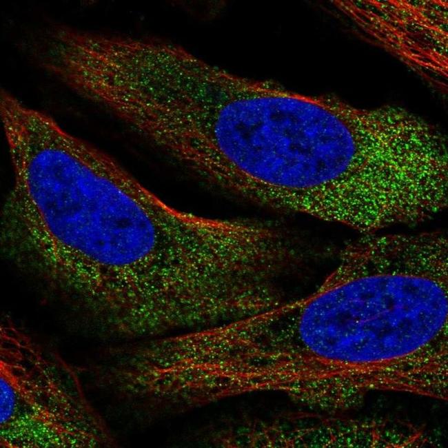 ARHGEF10L Antibody in Immunocytochemistry (ICC/IF)