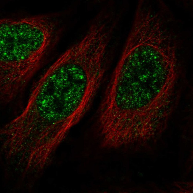 BIKE Antibody in Immunocytochemistry (ICC/IF)