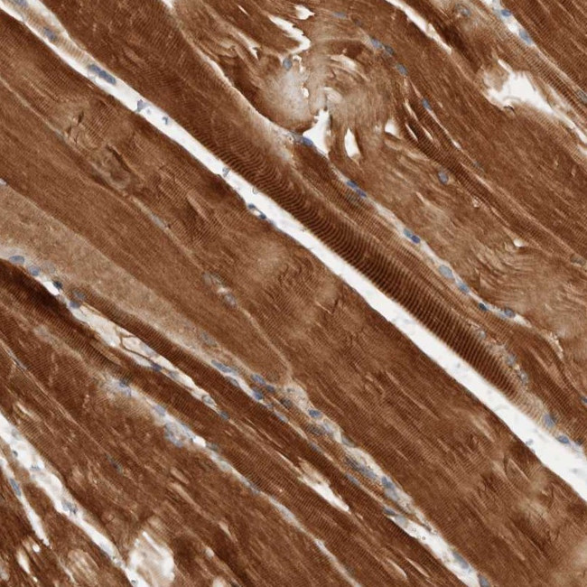 AMPD1 Antibody in Immunohistochemistry (Paraffin) (IHC (P))