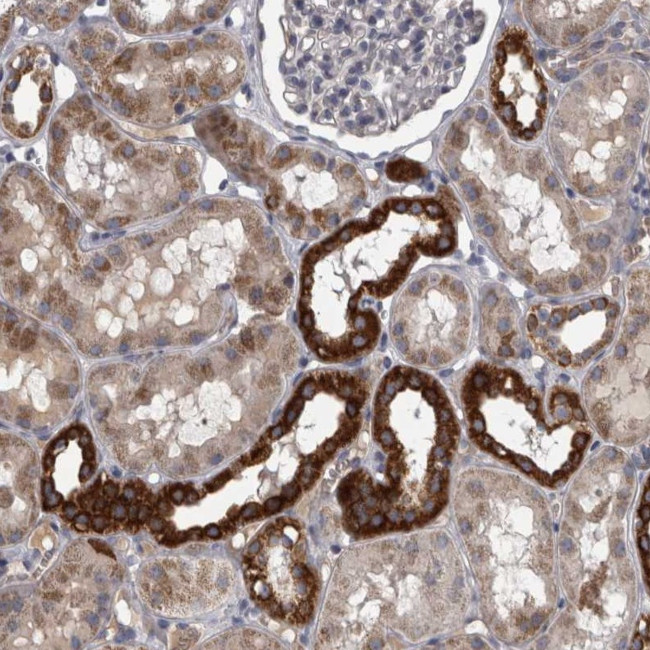 DBT Antibody in Immunohistochemistry (Paraffin) (IHC (P))