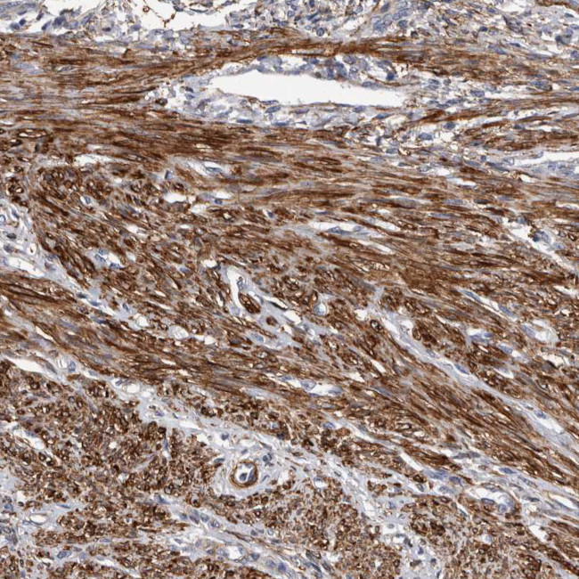 EPRS Antibody in Immunohistochemistry (Paraffin) (IHC (P))