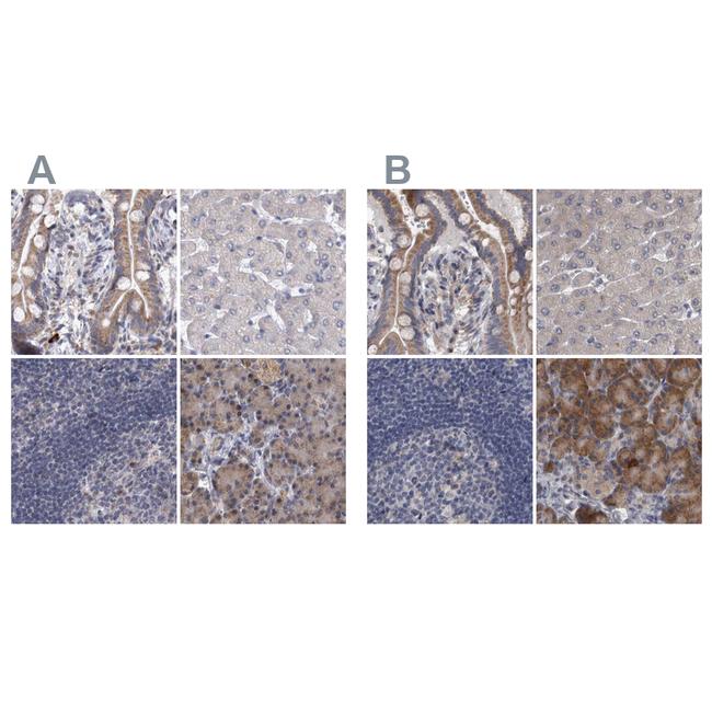 DBT Antibody in Immunohistochemistry (IHC)