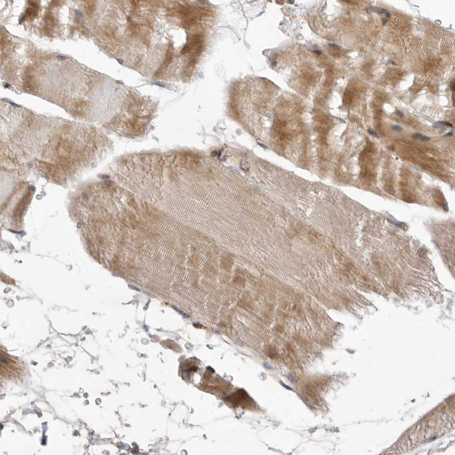 CCBL2 Antibody in Immunohistochemistry (Paraffin) (IHC (P))