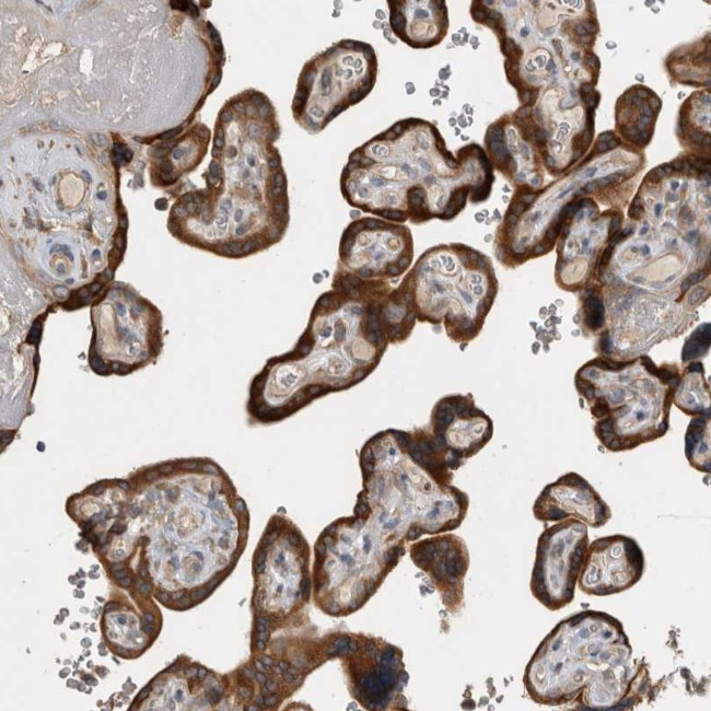 TBCE Antibody in Immunohistochemistry (Paraffin) (IHC (P))