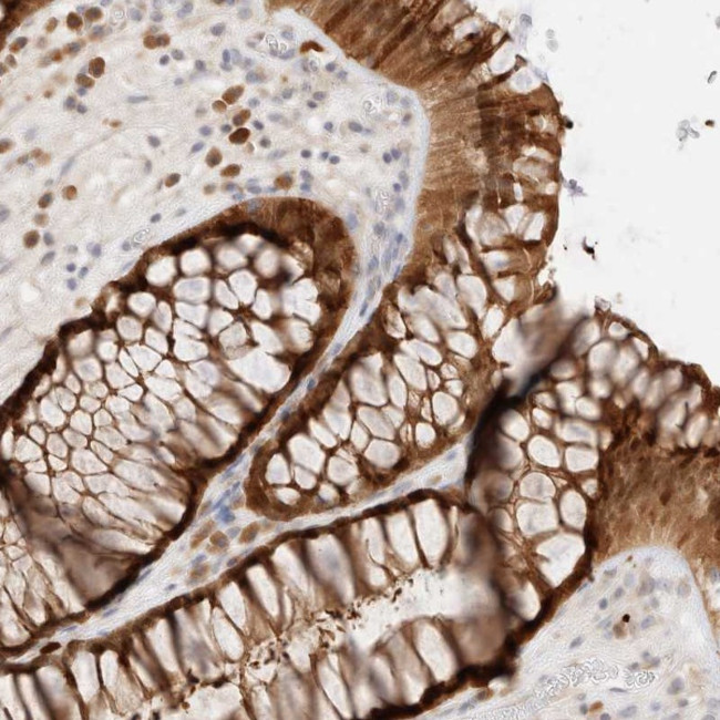 EFCAB13 Antibody in Immunohistochemistry (Paraffin) (IHC (P))