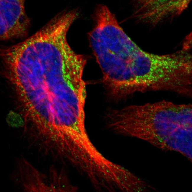 P4HA1 Antibody in Immunocytochemistry (ICC/IF)