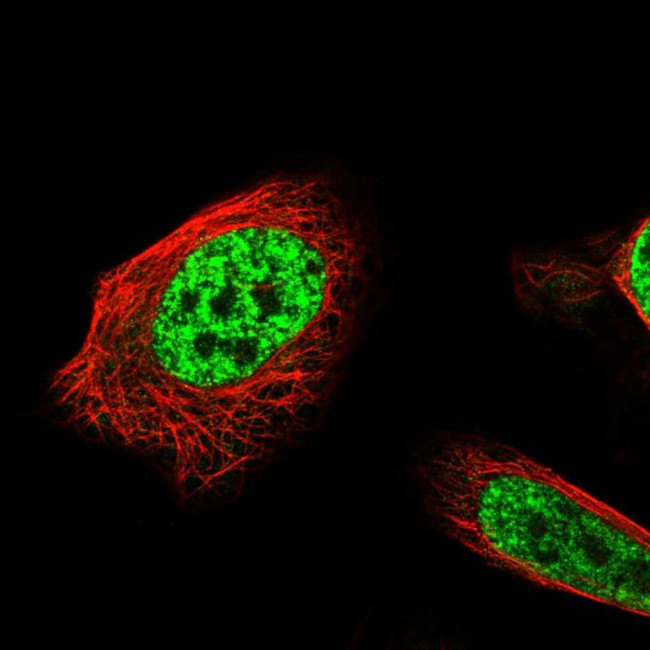 API5 Antibody in Immunocytochemistry (ICC/IF)