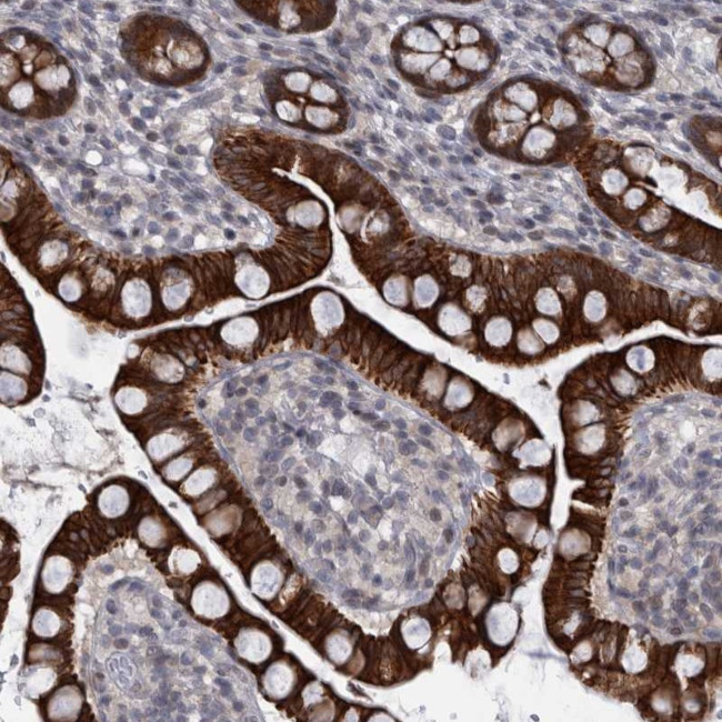 DIEXF Antibody in Immunohistochemistry (Paraffin) (IHC (P))