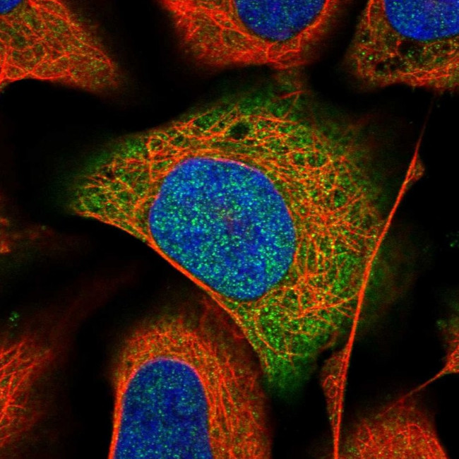 APRT Antibody in Immunocytochemistry (ICC/IF)