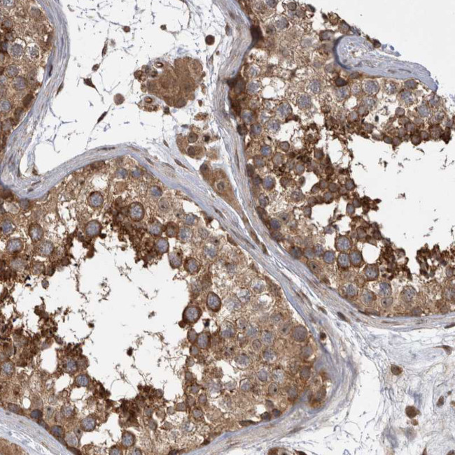 DHDDS Antibody in Immunohistochemistry (Paraffin) (IHC (P))