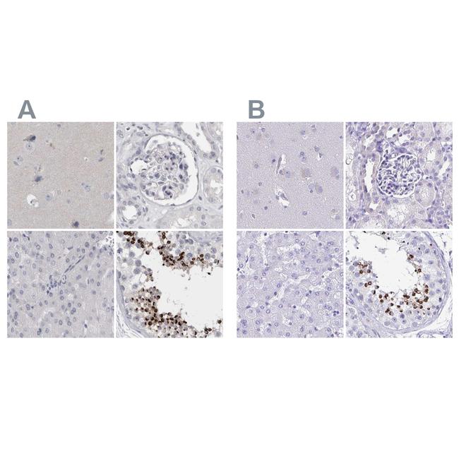 SPACA1 Antibody in Immunohistochemistry (IHC)