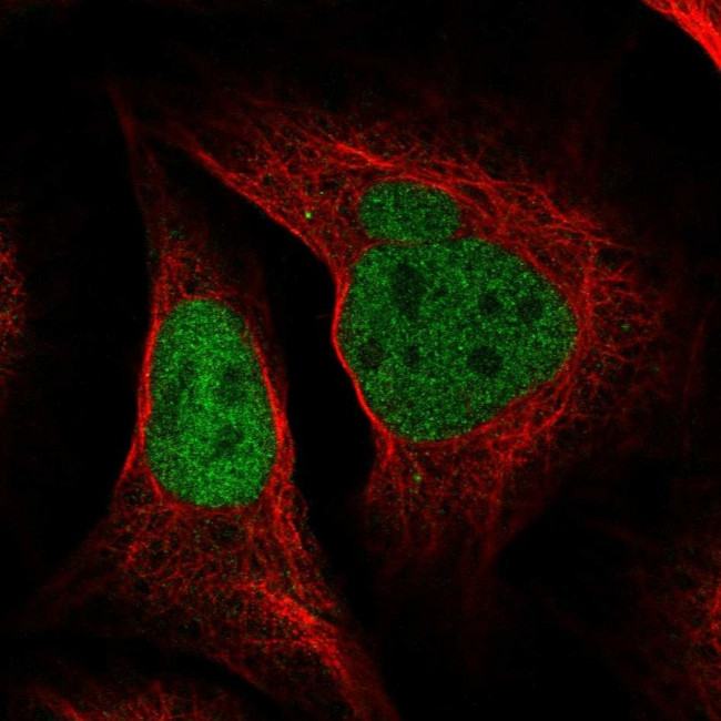 POLD2 Antibody in Immunocytochemistry (ICC/IF)