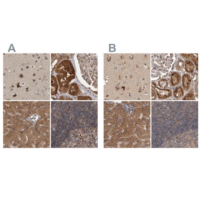 TRMT61B Antibody in Immunohistochemistry (IHC)