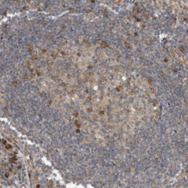 USE1 Antibody in Immunohistochemistry (Paraffin) (IHC (P))