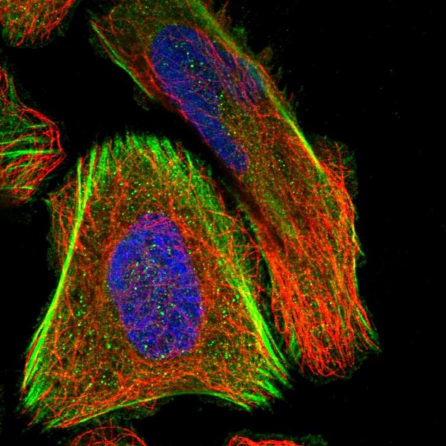 SCNN1D Antibody in Immunocytochemistry (ICC/IF)