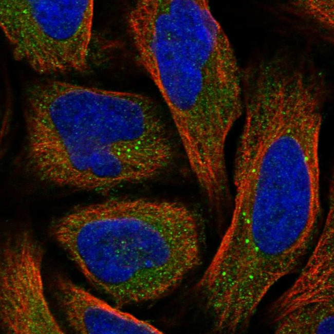 SRD5A3 Antibody in Immunocytochemistry (ICC/IF)