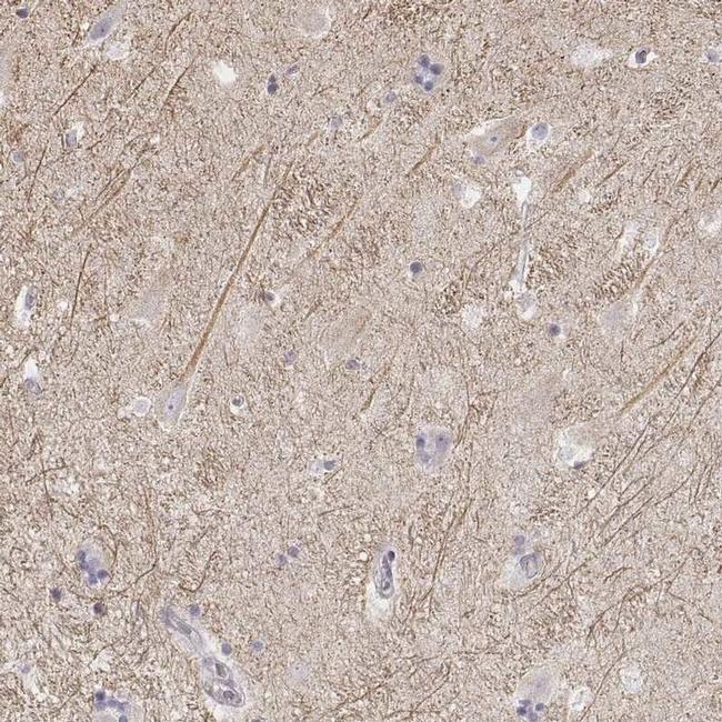 Kir2.2 (KCNJ12) Antibody in Immunohistochemistry (IHC)