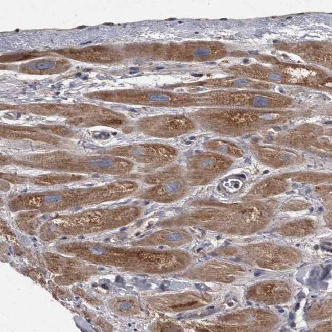 PPP1R3C Antibody in Immunohistochemistry (Paraffin) (IHC (P))