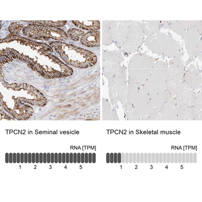 TPCN2 Antibody in Immunohistochemistry (IHC)