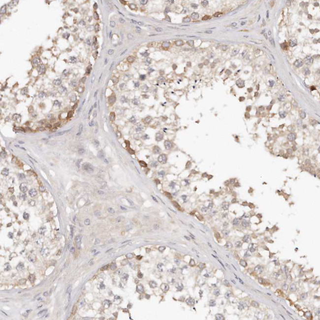 TTLL4 Antibody in Immunohistochemistry (Paraffin) (IHC (P))