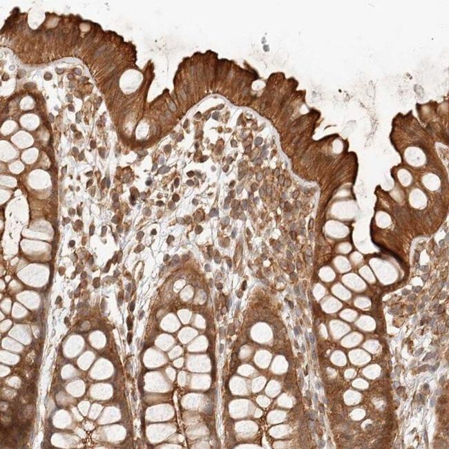 UFSP1 Antibody in Immunohistochemistry (IHC)