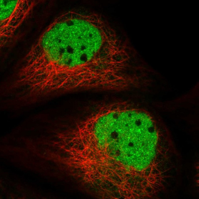 ADPRHL2 Antibody in Immunocytochemistry (ICC/IF)