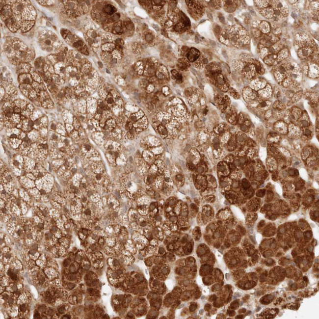 BAALC Antibody in Immunohistochemistry (Paraffin) (IHC (P))