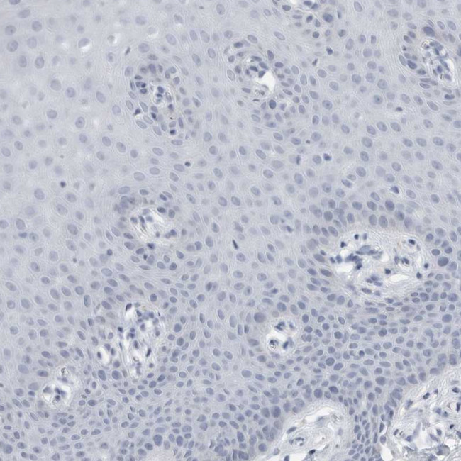 Tenascin R Antibody in Immunohistochemistry (Paraffin) (IHC (P))