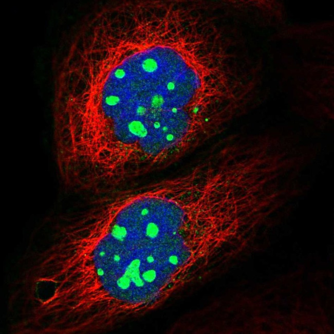 GNL2 Antibody in Immunocytochemistry (ICC/IF)