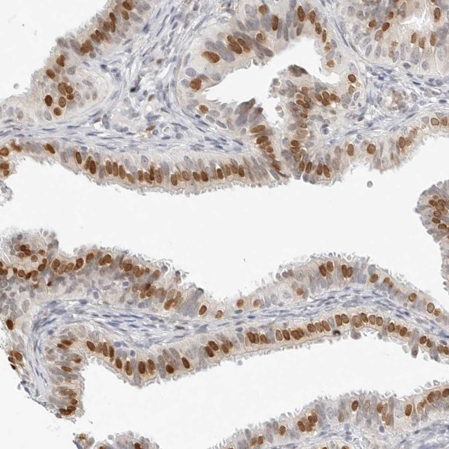 SPIDR Antibody in Immunohistochemistry (Paraffin) (IHC (P))