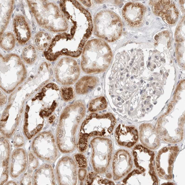 POLR3GL Antibody in Immunohistochemistry (Paraffin) (IHC (P))