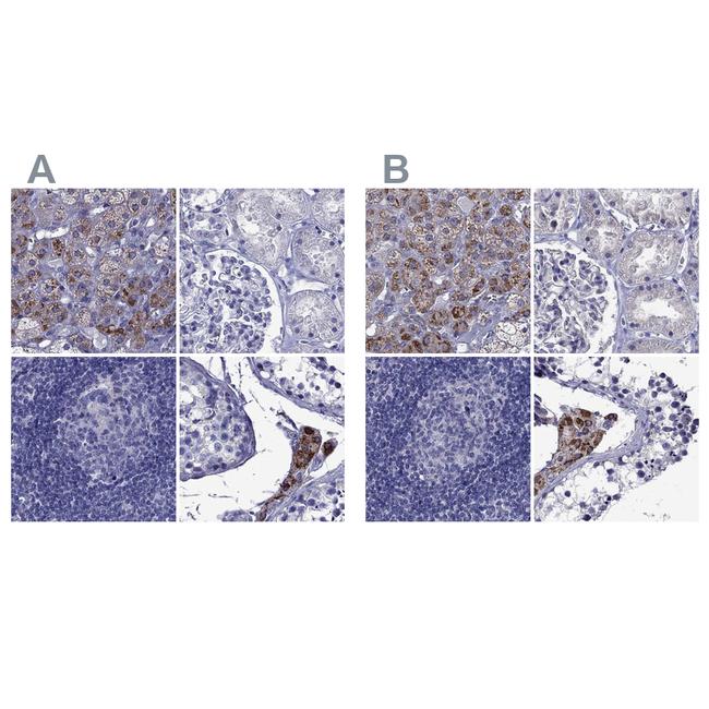 STAR Antibody in Immunohistochemistry (IHC)