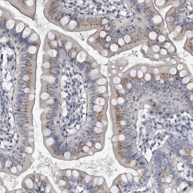 MYOC Antibody in Immunohistochemistry (Paraffin) (IHC (P))