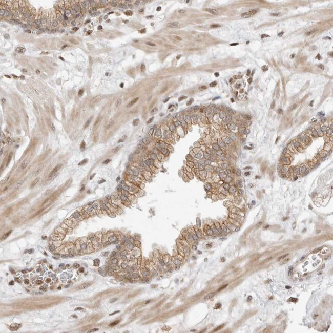 FAM150A Antibody in Immunohistochemistry (Paraffin) (IHC (P))