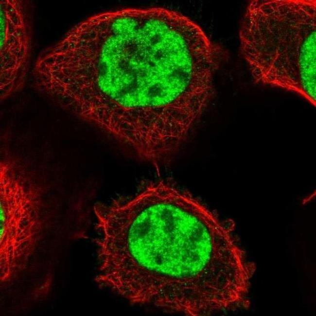 PPP1R8 Antibody in Immunocytochemistry (ICC/IF)