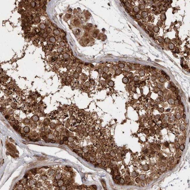 STK36 Antibody in Immunohistochemistry (IHC)