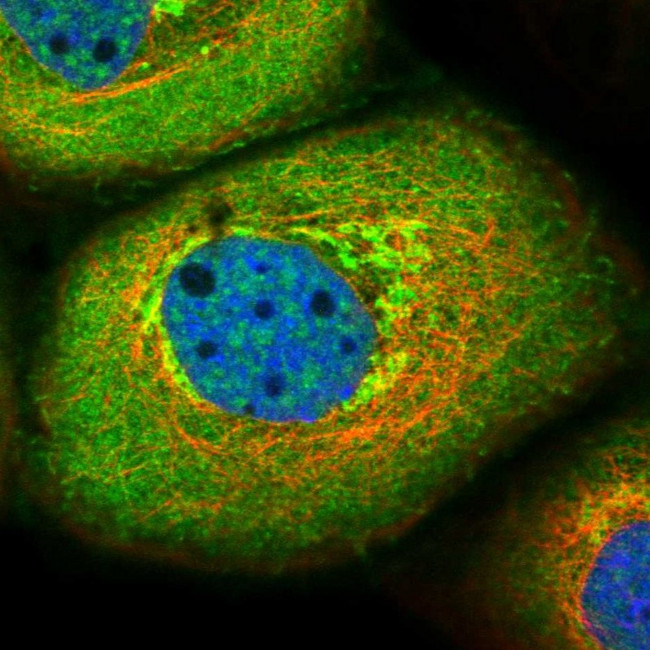 RC3H1 Antibody in Immunocytochemistry (ICC/IF)