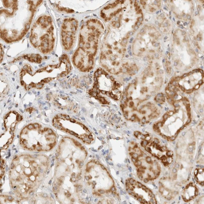 RC3H1 Antibody in Immunohistochemistry (Paraffin) (IHC (P))