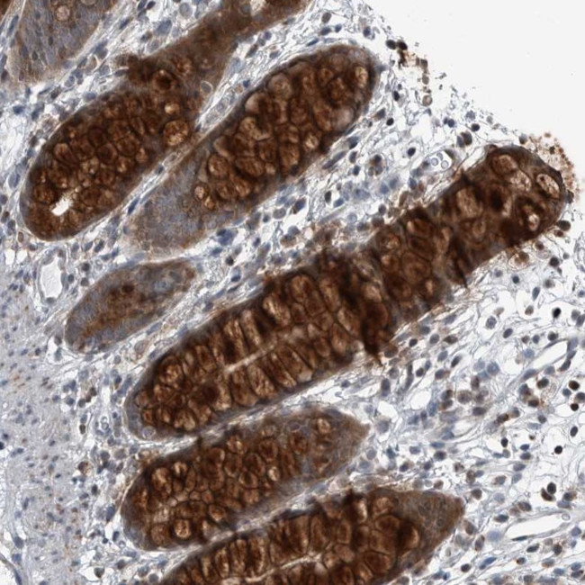 GAK Antibody in Immunohistochemistry (Paraffin) (IHC (P))