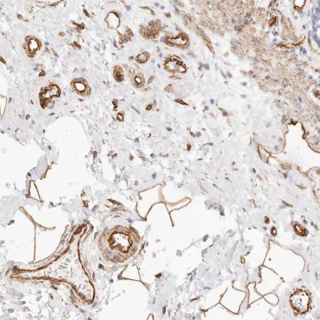 NUS1 Antibody in Immunohistochemistry (Paraffin) (IHC (P))