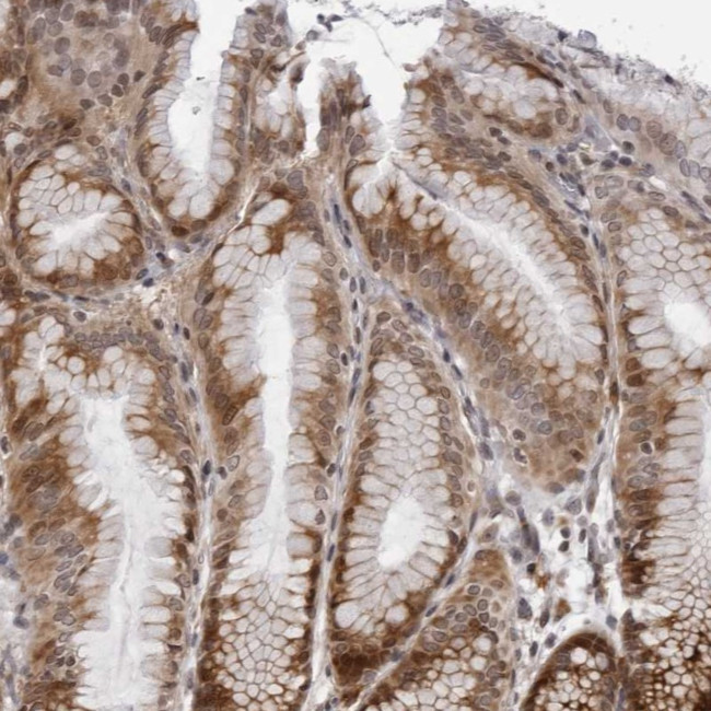 GCSAML Antibody in Immunohistochemistry (Paraffin) (IHC (P))