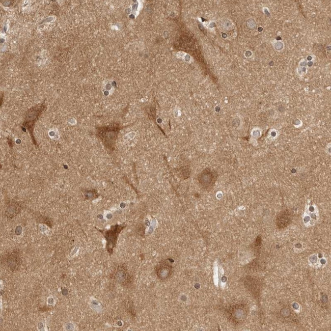 ATL1 Antibody in Immunohistochemistry (Paraffin) (IHC (P))