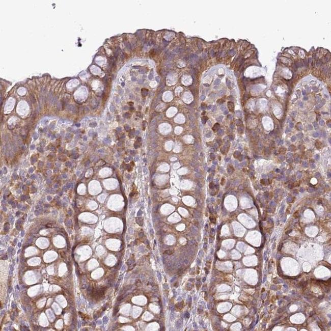 MOCS3 Antibody in Immunohistochemistry (IHC)