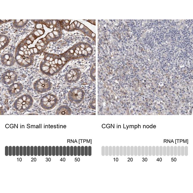 CGN Antibody in Immunohistochemistry (IHC)