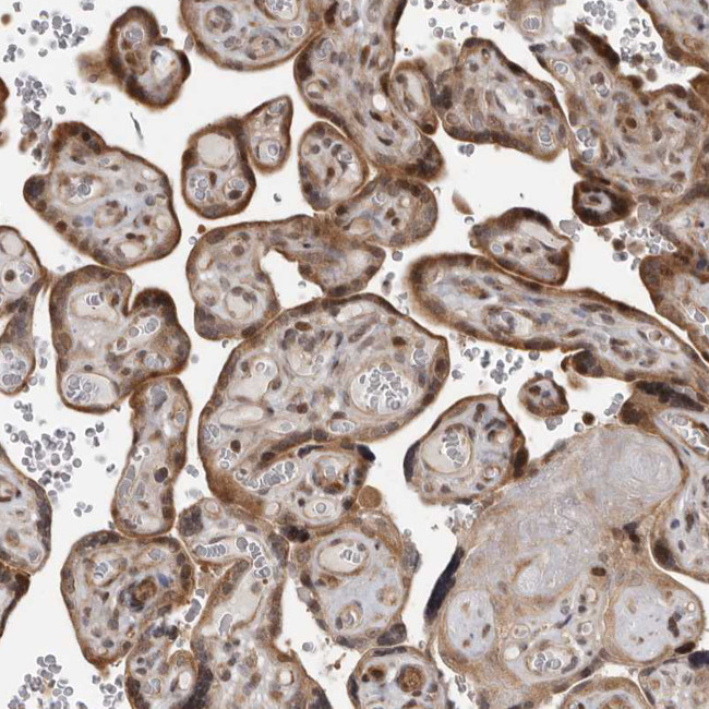 RABIF Antibody in Immunohistochemistry (Paraffin) (IHC (P))